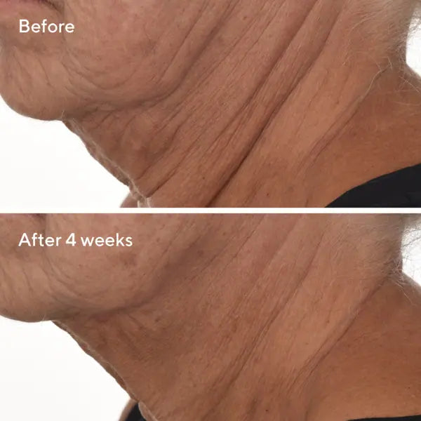 Murad Sale. Murad 15% Off. Murad Retinal ReSculpt Overnight Treatment