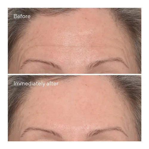 Murad Sale. Murad 15% off. Murad Targeted Wrinkle Corrector