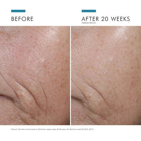 SkinCeuticals C E Ferulic Vitamin C Serum is a high potency serum with a combination of powerful antioxidants to protect skin against atmospheric ageing.
15% pure vitamin C (L-ascorbic acid), 1% vitamin E (alpha tocopherol), and 0.5% ferulic acid work in combination to protect against environmental damage and premature signs of ageing caused by free radical damage from UV rays, infrared radiation (IRA), and ozone pollution (O3).