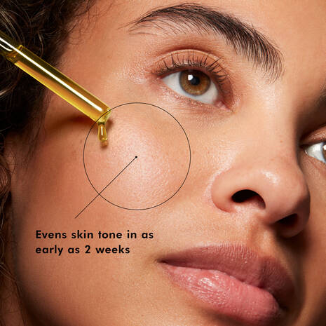 SkinCeuticals Discolouration Defense Dark Spot Serum is a layer-able, daily-use dark spot corrector clinically proven to reduce the appearance of key types of skin discolouration in all skin tones, including hard-to-treat forms such as hyperpigmentation.
Formulated with 3% tranexamic acid, 1% kojic acid, 5% niacinamide, and 5% HEPES, this formula serum for dark spots improves the appearance of skin discolouration, brightens skin, and evens skin tone in as early as 2 weeks.