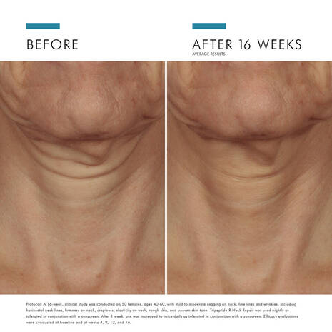 SkinCeuticals Tripeptide-R Neck Repair Cream is a potent neck cream formulated with a blend of peptide and retinol to visibly improve signs of ageing on the neck, including wrinkles, crepiness and uneven skin tone. The peptide and retinol blend works two-fold to promote collagen production that impacts skin elasticity, and speed up skin cell turnover to reveal fresher skin.
