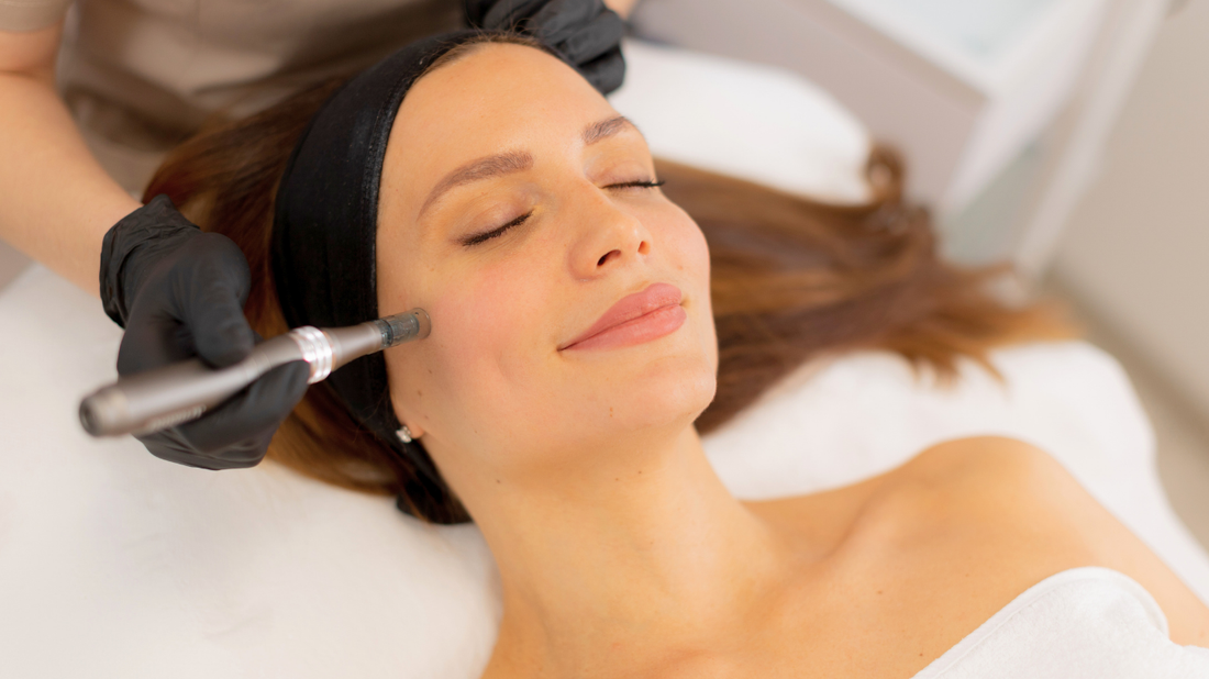 Dermapen4 skin needling treatment at Skin Deep Medispa for skin rejuvenation, acne scarring, texture and collagen support.
