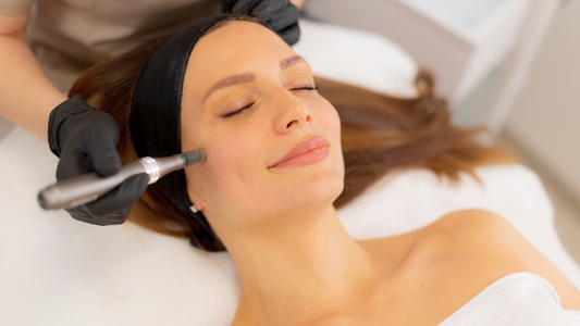 Dermapen4 skin needling treatment at Skin Deep Medispa for skin rejuvenation, acne scarring, texture and collagen support.
