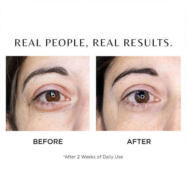 Cosmedix Elite I-Complex Advanced Eye Gel before and after results for under-eye lines, hydration and brighter-looking skin.