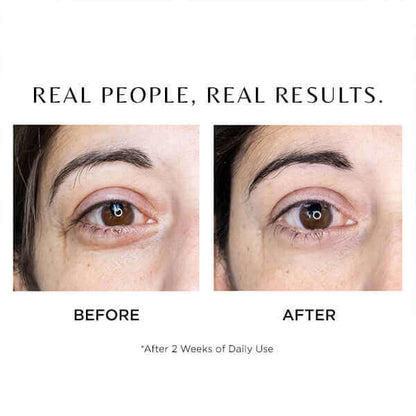 Cosmedix Elite I-Complex Advanced Eye Gel before and after results for under-eye lines, hydration and brighter-looking skin.