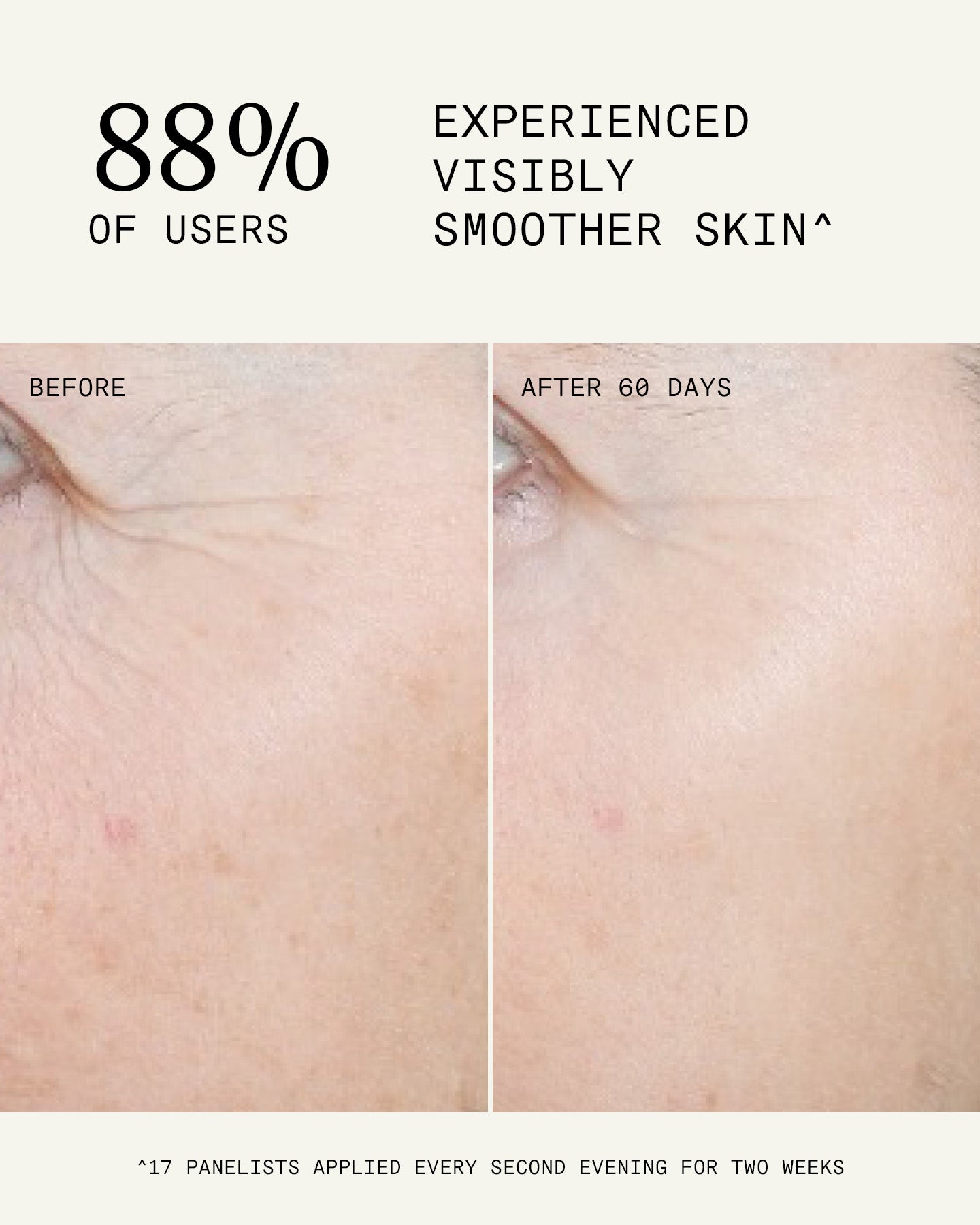 Ultraceuticals Ultra A Perfecting Serum Mild