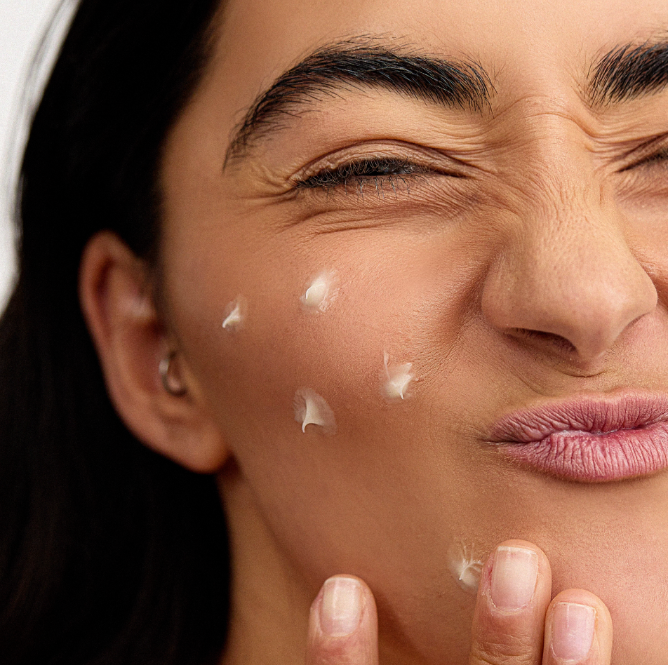Woman applying INSKIN.CO Blemish Control Cream to face showing lightweight blemish-control moisturiser for acne-prone skin.