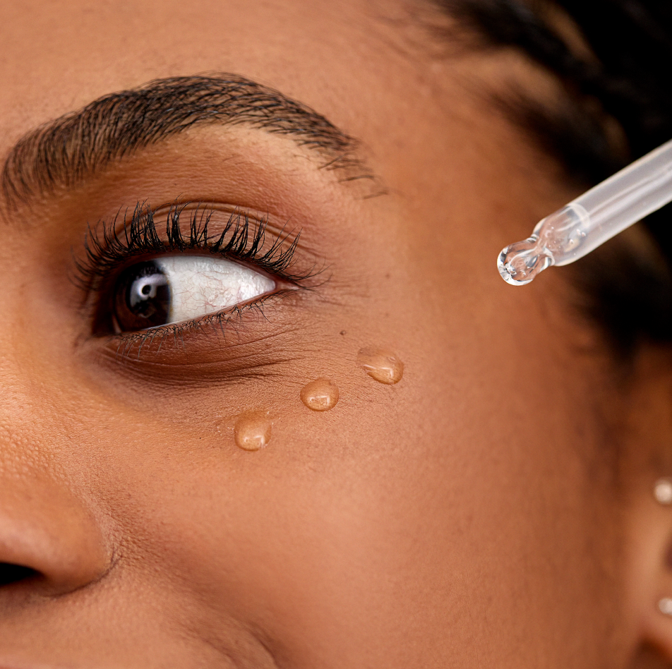 Woman applying INSKIN.CO Multi-Active & BHA Serum to face showing lightweight salicylic acid treatment for breakouts and uneven texture.