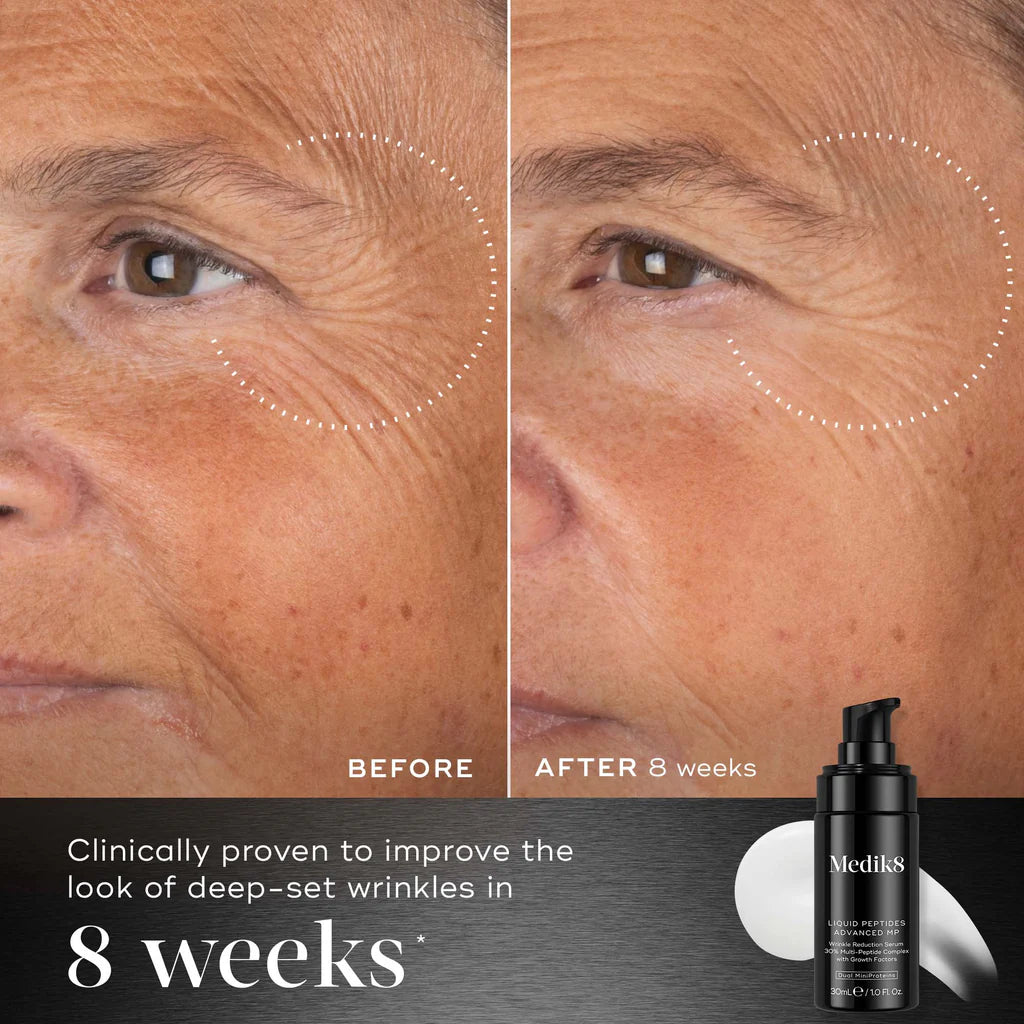 Medik8 Sale. Medik8 Liquid Peptides Advanced MP. Fine lines, expression lines, and deep-set wrinkles are visibly smoothed as the lightweight serum visibly plumps, firms and refines uneven skin texture.