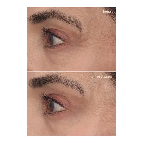 Murad Sale. Murad 15% Off. Murad Retinal ReSculpt Eye Treatment