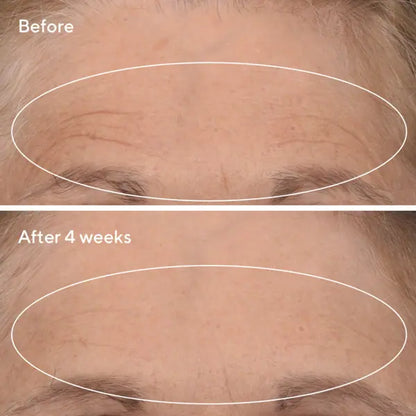 Murad Sale. Murad 15% Off. Murad Retinal ReSculpt Overnight Treatment