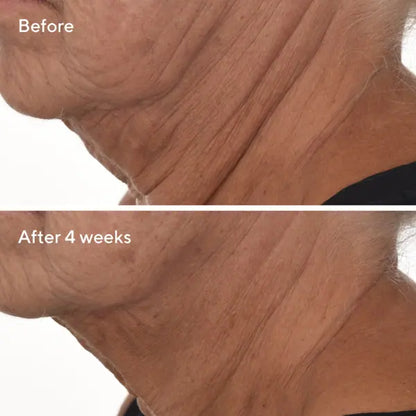 Murad Sale. Murad 15% Off. Murad Retinal ReSculpt Overnight Treatment