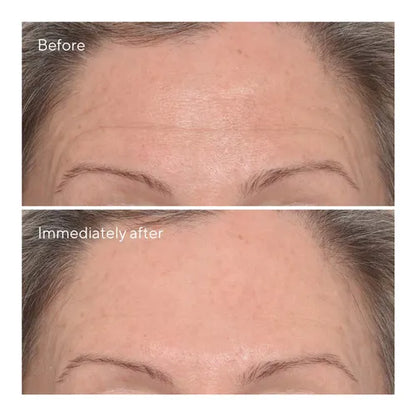 Murad Sale. Murad 15% off. Murad Targeted Wrinkle Corrector