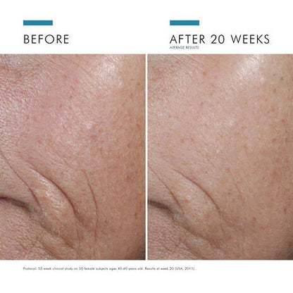 SkinCeuticals C E Ferulic Vitamin C Serum is a high potency serum with a combination of powerful antioxidants to protect skin against atmospheric ageing.

15% pure vitamin C (L-ascorbic acid), 1% vitamin E (alpha tocopherol), and 0.5% ferulic acid work in combination to protect against environmental damage and premature signs of ageing caused by free radical damage from UV rays, infrared radiation (IRA), and ozone pollution (O3).