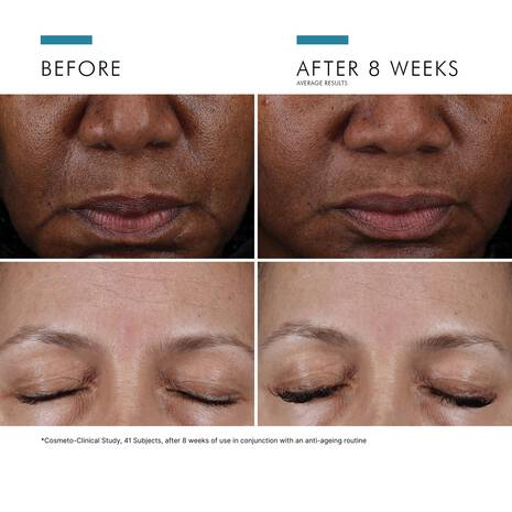 SkinCeuticals Cell Cycle Catalyst before and after image showing visible improvement in skin texture and overall skin appearance after continued use.