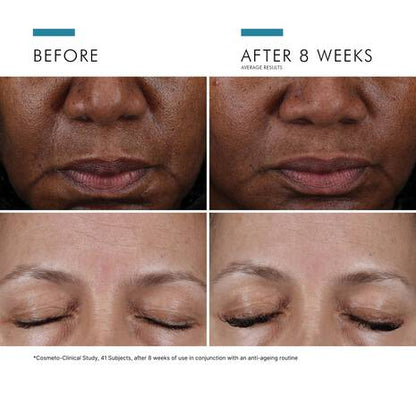 SkinCeuticals Cell Cycle Catalyst before and after image showing visible improvement in skin texture and overall skin appearance after continued use.