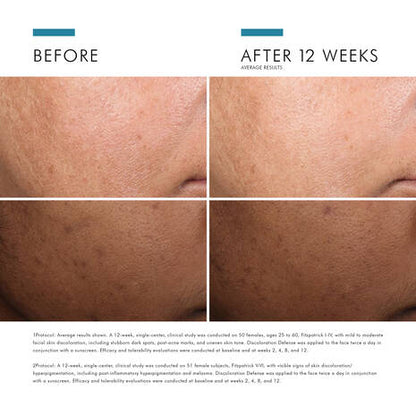 SkinCeuticals Discoloration Defense is formulated with 3% tranexamic acid, 1% kojic acid, 5% niacinamide, and 5% HEPES, and improves the appearance of skin discolouration, and evens skin tone in as early as 2 weeks.