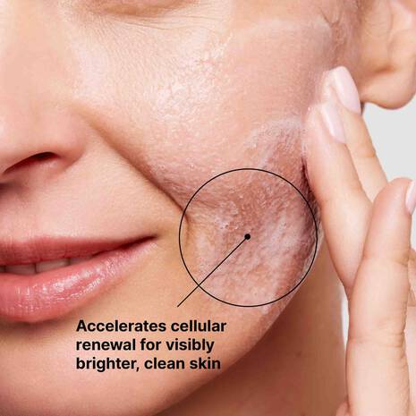 SkinCeuticals Glycolic Renewal Foaming Cleanser is a high-concentration soft-foaming cleanser designed to effectively exfoliate rough skin.

Formulated with 8% glycolic acid combined with 1% phytic acid, aloe leaf juice and glycerin, this glycolic acid cleanser helps deliver a clear and bright complexion while removing oil, dirt, debris, and long-wear makeup without stripping the skin of moisture.