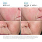 SkinCeuticals Phyto Corrective Essence Hydrating Mist hydrates and helps reduce visible redness while also supporting the skin's moisture barrier, in a touch-less facial mist spray. A phytobotanical blend of boldus leaf, cucumber, thyme, olive leaf, and rosemary extracts support skin health, while a 6.2% blend of hyaluronic acid and glycerin helps absorb and retain water in the skin.