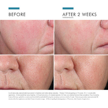 SkinCeuticals Phyto Corrective Essence Hydrating Mist showing visible improvement in redness after consistent use on sensitive skin.