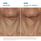 SkinCeuticals Tripeptide-R Neck Repair Cream is a potent neck cream formulated with a blend of peptide and retinol to visibly improve signs of ageing on the neck, including wrinkles, crepiness and uneven skin tone. The peptide and retinol blend works two-fold to promote collagen production that impacts skin elasticity, and speed up skin cell turnover to reveal fresher skin.