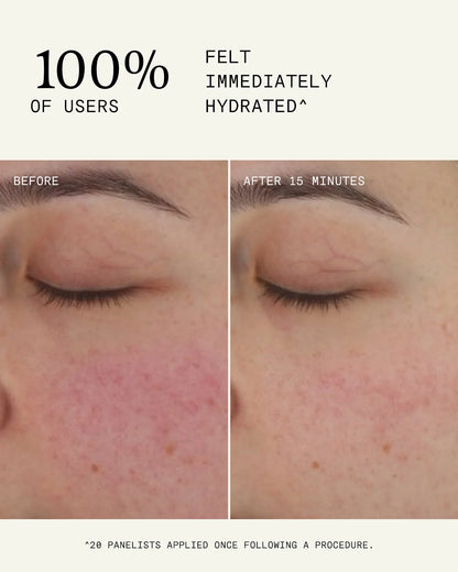 Ultraceuticals Ultra B² Recovery Cream clinically proven hydration and visible redness reduction after post-procedure application.