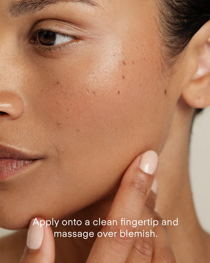 Ultraceuticals Ultra Clear Spot Complex skincare routine for blemish-prone skin with Ultra Clear Foaming Cleanser and targeted spot treatment.