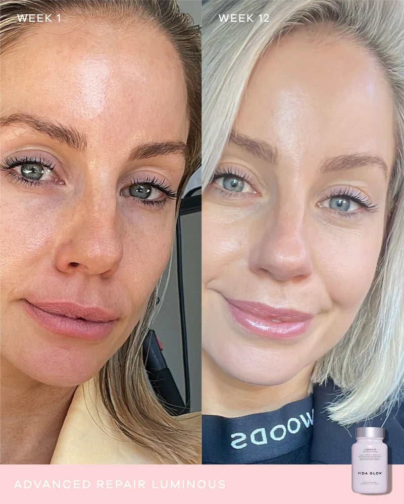 Vida Glow Advanced Repair Luminous clinical results image demonstrating improved skin luminosity, radiance and tone over 12 weeks.