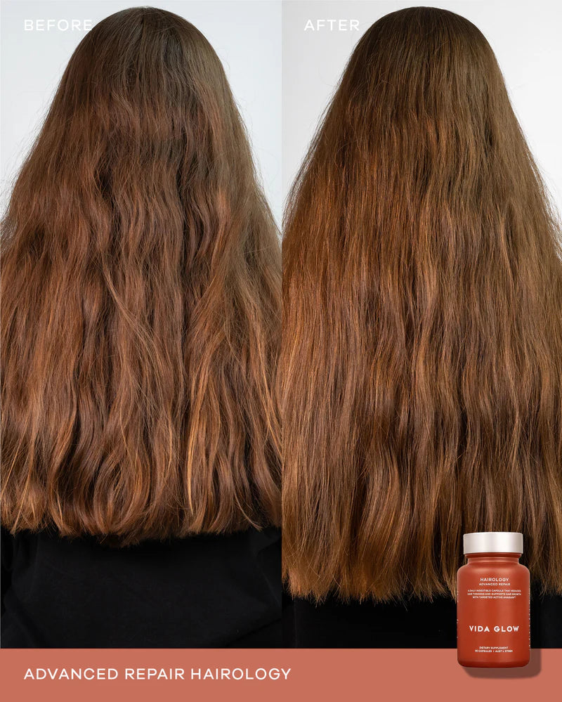 Vida Glow Advanced Repair Hairology before and after results showing longer, fuller-looking hair and improved overall hair condition.
