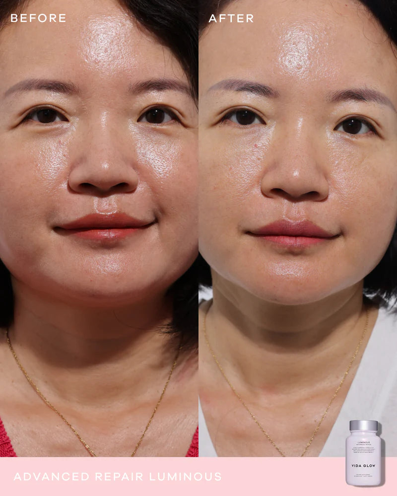 Vida Glow Advanced Repair Luminous before and after results showing visibly brighter, more even-looking skin and improved complexion clarity.