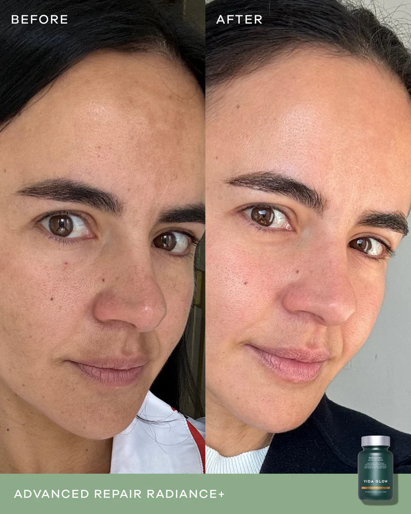 Vida Glow Advanced Repair Radiance+ before and after imagery showing improvement in visible pigmentation and skin tone.