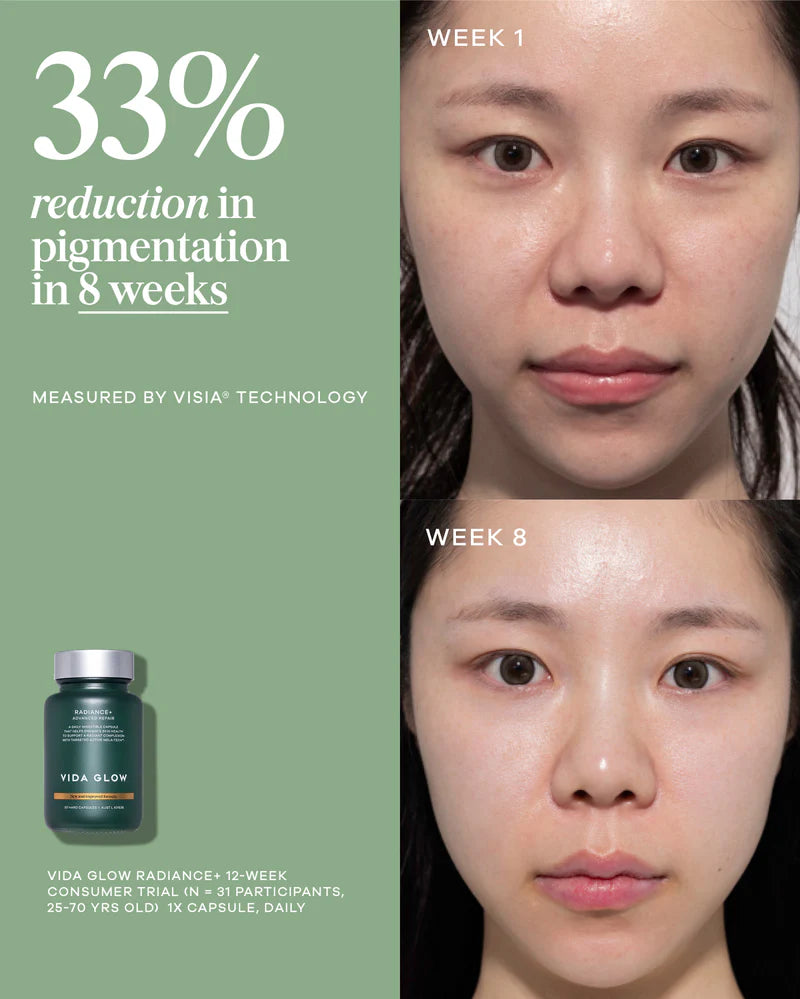 Vida Glow Advanced Repair Radiance+ clinical pigmentation before and after results for brighter, more even-looking skin.