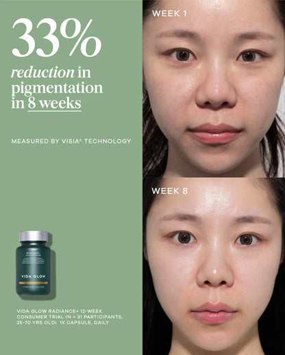 Vida Glow Advanced Repair Radiance+ clinical pigmentation before and after results for brighter, more even-looking skin.
