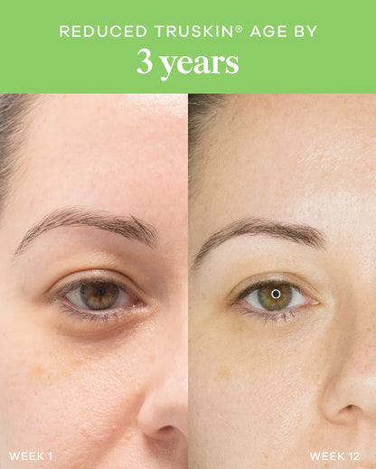 Vida Glow Liquid Collagen Skin + Energy Green Apple before and after skin results showing improved skin smoothness and a more youthful-looking complexion.