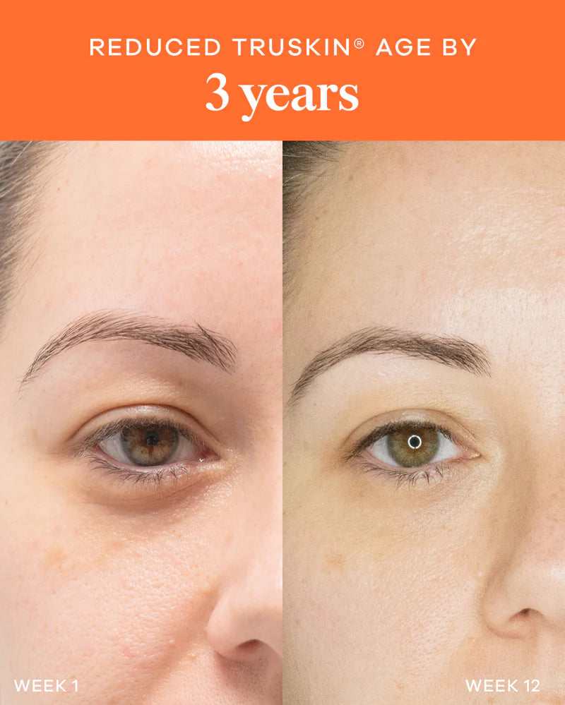 Vida Glow Liquid Collagen Skin + Gut Tropical before and after results showing improved skin smoothness and younger-looking eye area.
