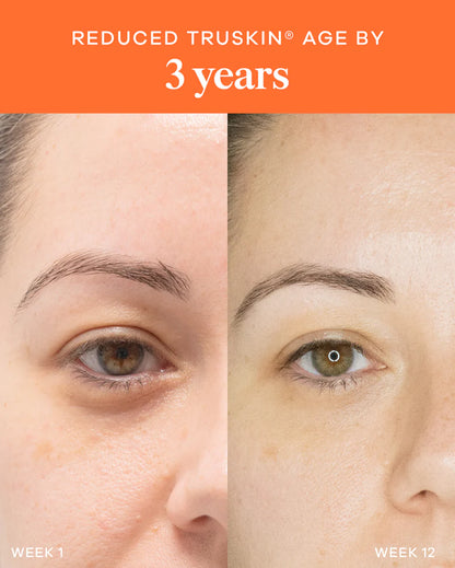 Vida Glow Liquid Collagen Skin + Gut Tropical before and after results showing improved skin smoothness and younger-looking eye area.