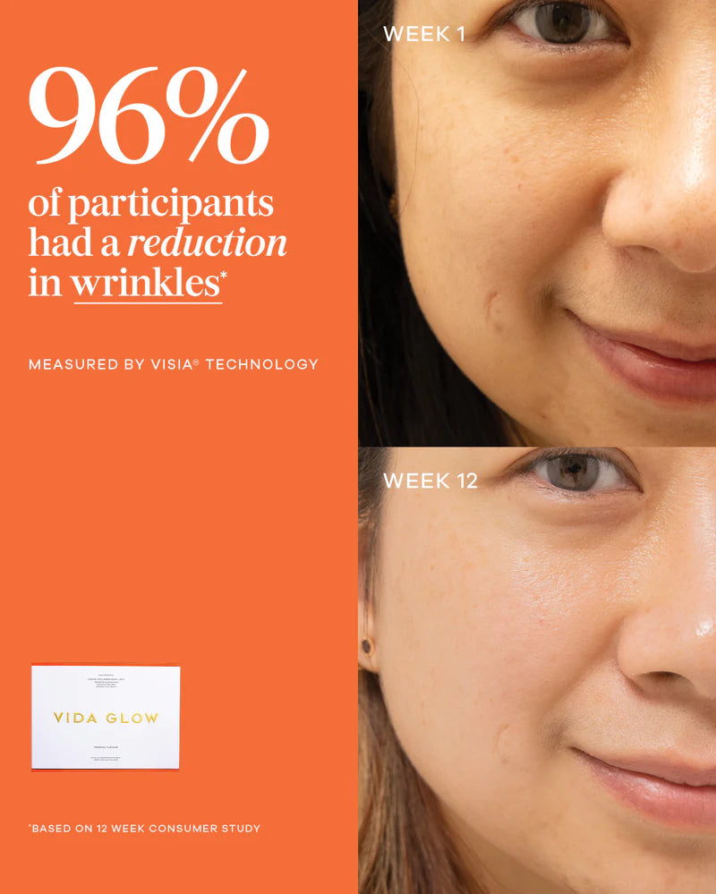 Vida Glow Liquid Collagen Skin + Gut Tropical clinical results image showing visible wrinkle reduction and smoother-looking skin.