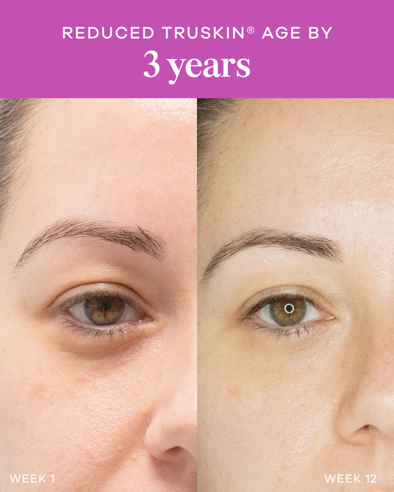 Vida Glow Liquid Collagen Skin Health Mixed Berry before and after results image showing smoother-looking skin and reduced visible signs of ageing.