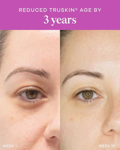 Vida Glow Liquid Collagen Skin Health Mixed Berry before and after results image showing smoother-looking skin and reduced visible signs of ageing.
