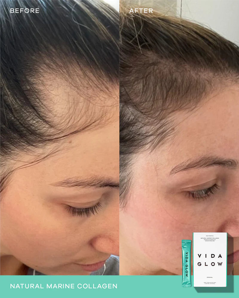 Vida Glow Natural Marine Collagen - Blueberry before and after results highlighting smoother-looking skin and improved overall skin appearance.