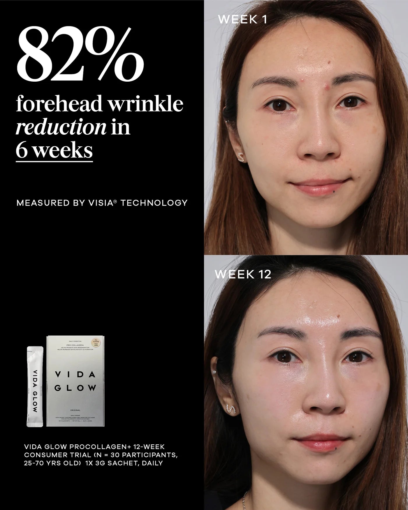 Vida Glow Pro Collagen+ ingestible collagen for visible skin rejuvenation, showing before and after improvement in forehead lines over 12 weeks.