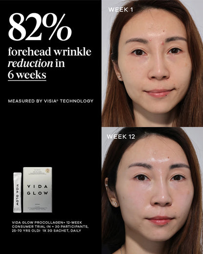 Vida Glow Pro Collagen+ ingestible collagen for visible skin rejuvenation, showing before and after improvement in forehead lines over 12 weeks.