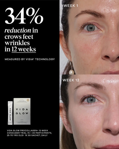 Vida Glow Pro Collagen+ daily marine collagen supplement for skin elasticity and wrinkle reduction, showing before and after improvement in crow’s feet.