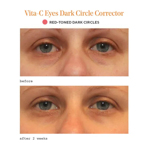 Murad Sale. Murad 15% Off. Murad Vita-C Eyes Dark Circle Corrector