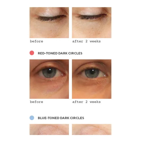 Murad Sale. Murad 15% Off. Murad Vita-C Eyes Dark Circle Corrector