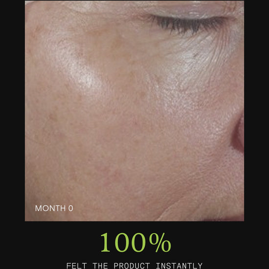 Ultraceuticals HA 360 Facial Serum results for plumper, deeply hydrated skin and a stronger moisture barrier.