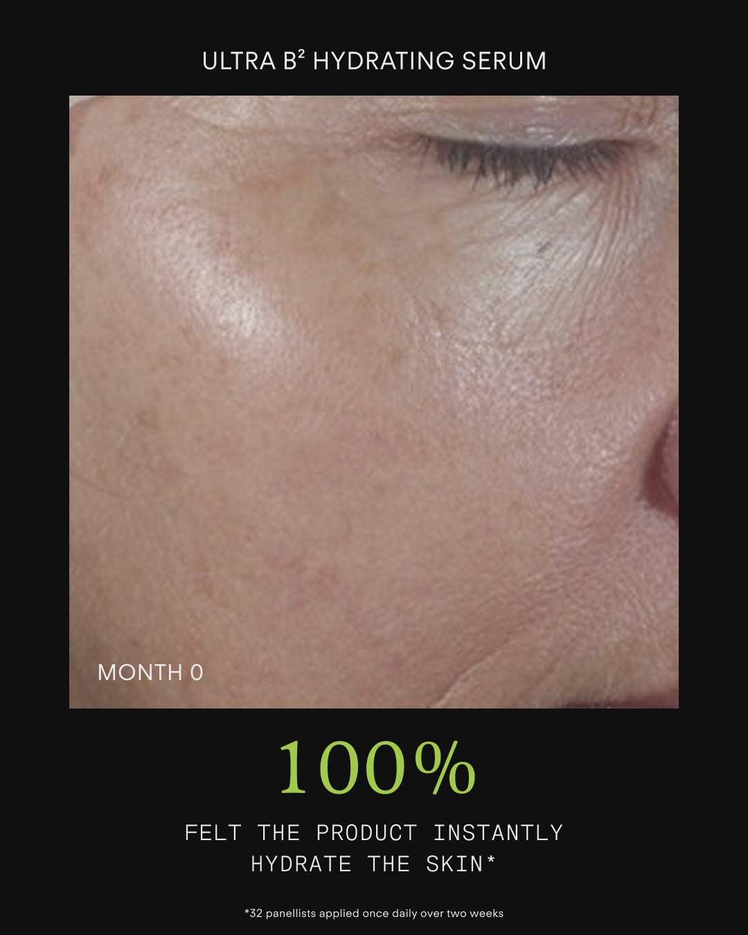 Ultraceuticals HA 360 Facial Serum results for plumper, deeply hydrated skin and a stronger moisture barrier.
