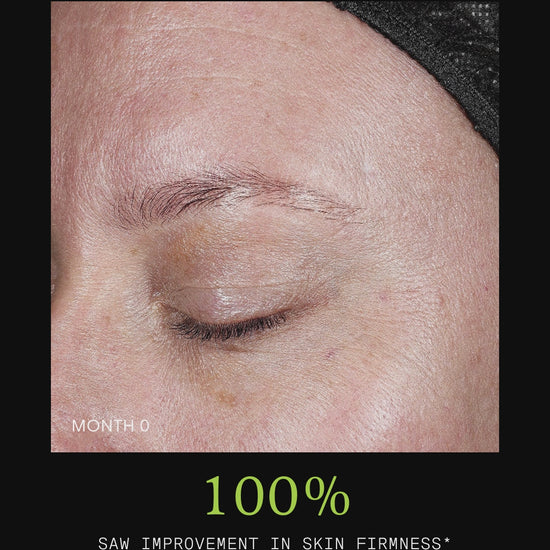 Ultraceuticals C Chebula Facial Serum results for brighter, firmer and more even-looking skin.