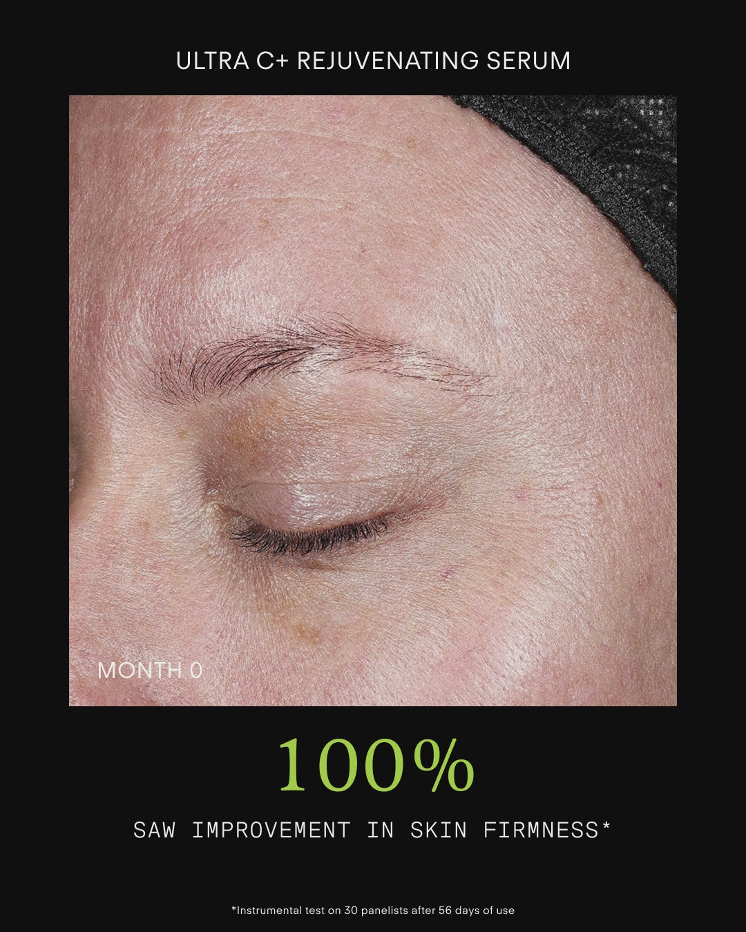 Ultraceuticals C Chebula Facial Serum results for brighter, firmer and more even-looking skin.