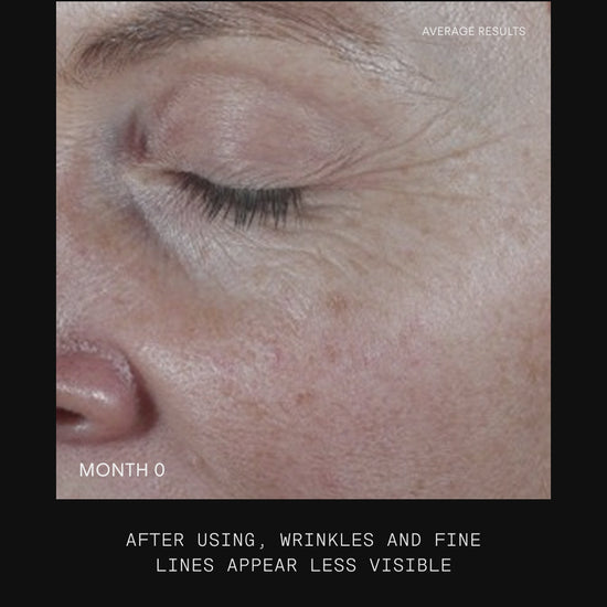 Ultraceuticals Retinome Facial Serum Mild results for visibly smoother skin, softened fine lines and improved texture.